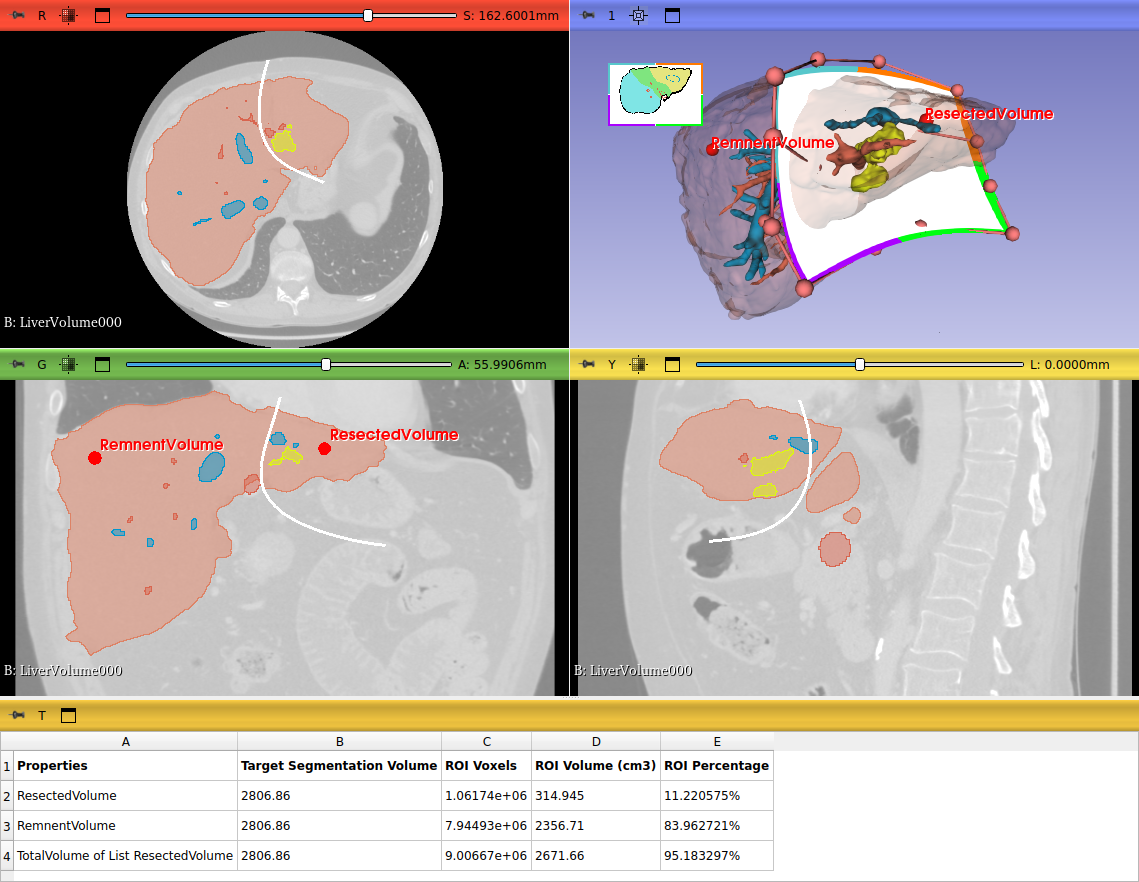 Slicer-Liver_screenshot_19.png