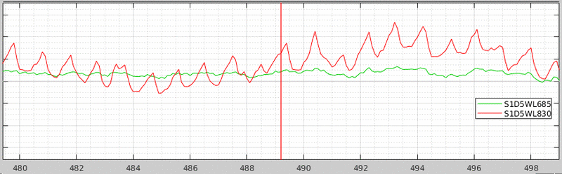 SCI signal motor