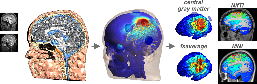 simnibs_workflow.png