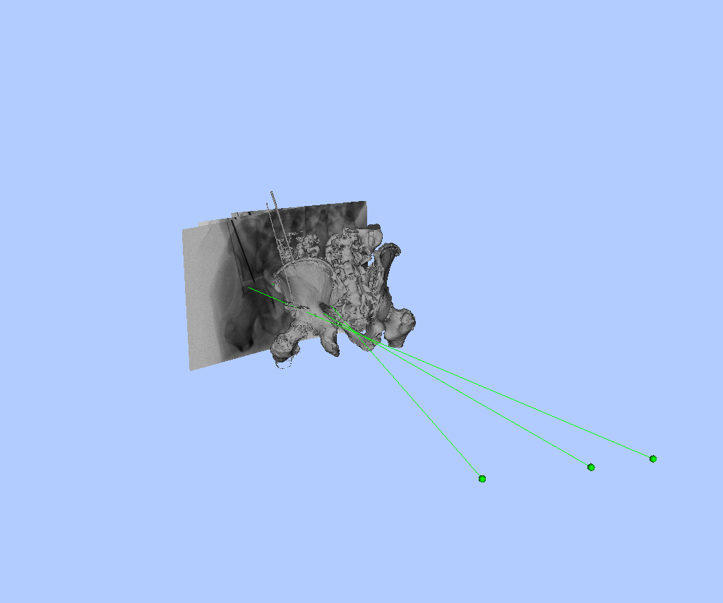 Example 1 X-ray Scene Surface 2