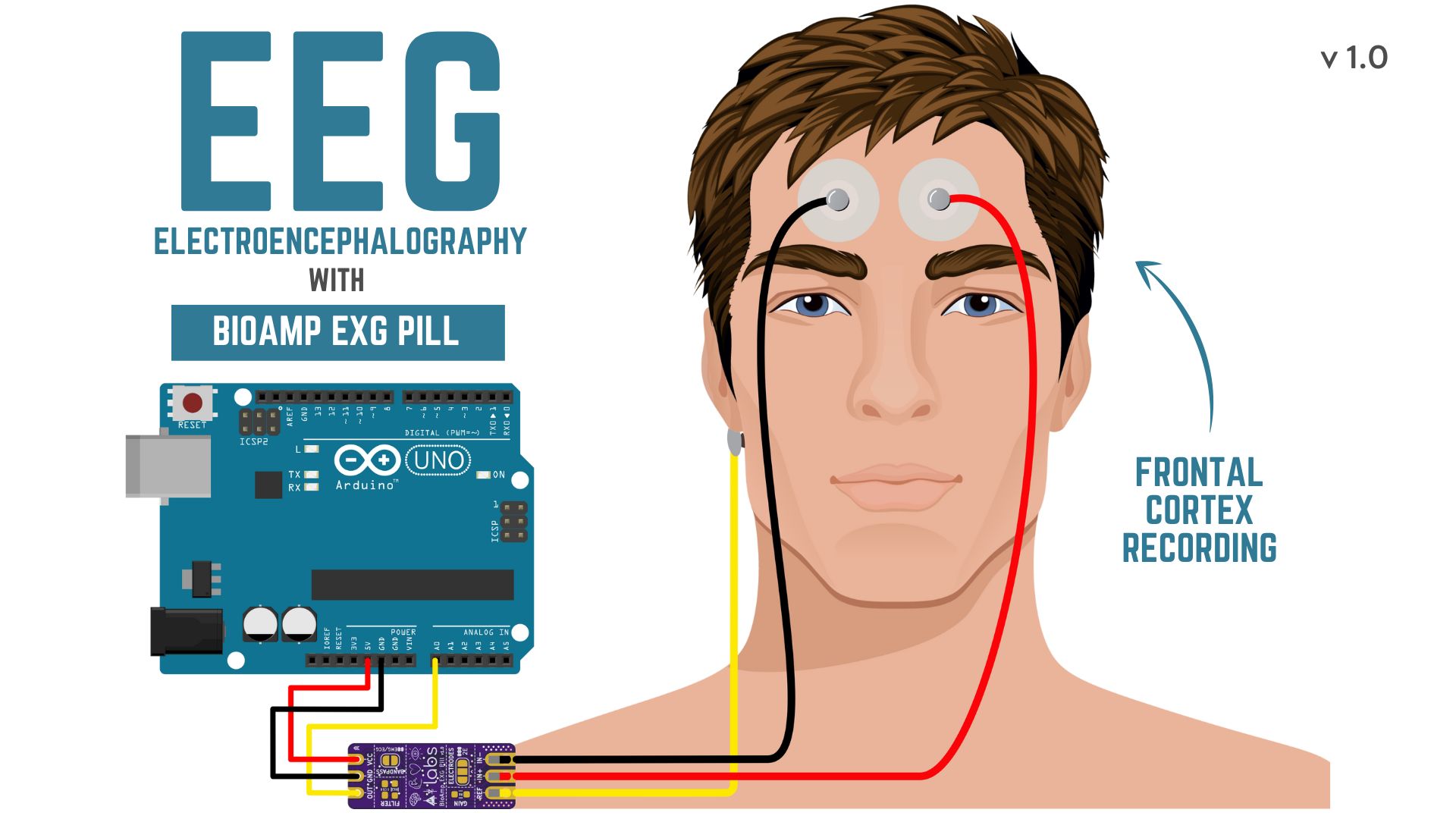 EEG.jpg